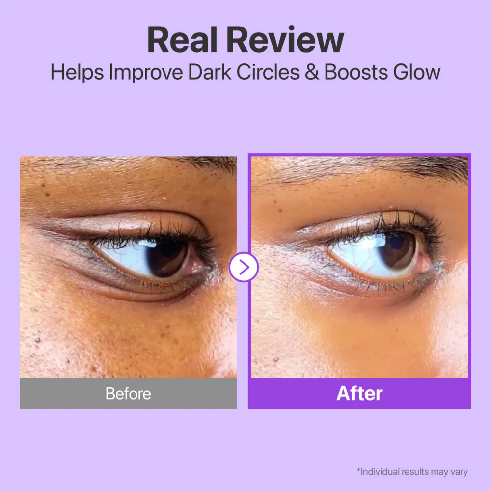 SkinCare - Contorno de Ojos No.9 NAD+ Volumizing Eye Cream | Numbuzin